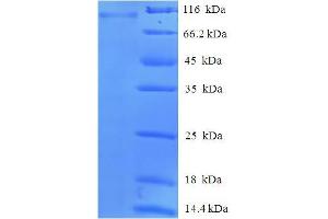 SDS-PAGE (SDS) image for Peptidyl Arginine Deiminase, Type II (PADI2) (AA 1-665), (full length) protein (His-SUMO Tag) (ABIN5711981)