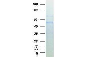 Western Blotting (WB) image for Embryonic Ectoderm Development (EED) (Transcript Variant 1) protein (Myc-DYKDDDDK Tag) (ABIN2729340)
