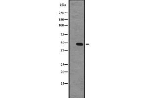 Western blot analysis of GPR63 expression in CEM cell lysate ;,The lane on the left is treated with the antigen-specific peptide. (GPR63 Antikörper  (Internal Region))