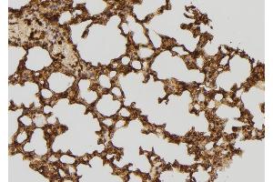 ABIN6277609 at 1/100 staining Mouse lung tissue by IHC-P. (RFC4 Antikörper)