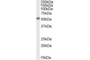 Image no. 1 for anti-STEAP Family Member 4 (STEAP4) (C-Term) antibody (ABIN375107) (STEAP4 Antikörper  (C-Term))