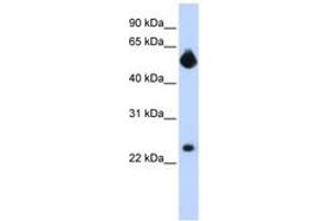 Image no. 1 for anti-Notch 4 (NOTCH4) (Internal Region) antibody (ABIN6742248) (NOTCH4 Antikörper  (Internal Region))
