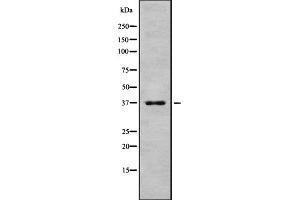 Western blot analysis of Peropsin using HeLa whole cell lysates (Peropsin Antikörper  (Internal Region))