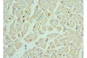 Immunohistochemistry of paraffin-embedded human heart tissue using ABIN7145306 at dilution of 1:100 (BCL2L13 Antikörper  (AA 1-300))