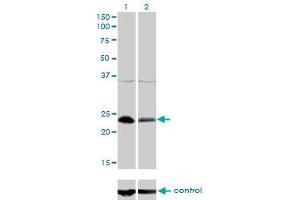 Western blot analysis of NFYB over-expressed 293 cell line, cotransfected with NFYB Validated Chimera RNAi (Lane 2) or non-transfected control (Lane 1). (NFYB Antikörper  (AA 1-207))