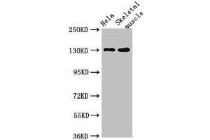 Western Blot Positive WB detected in: Hela whole cell lysate, Mouse skeletal muscle tissue All lanes: PER3 antibody at 4 μg/mL Secondary Goat polyclonal to rabbit IgG at 1/50000 dilution Predicted band size: 132, 133 kDa Observed band size: 132 kDa (PER3 Antikörper  (AA 1-131))