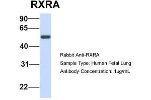 Host:  Rabbit  Target Name:  RXRA  Sample Type:  Human Fetal Lung  Antibody Dilution:  1. (Retinoid X Receptor alpha Antikörper  (N-Term))