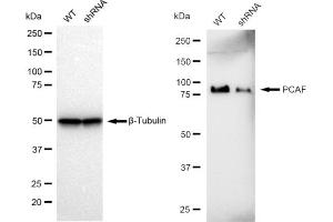 anti-K(lysine) Acetyltransferase 2B (KAT2B) antibody