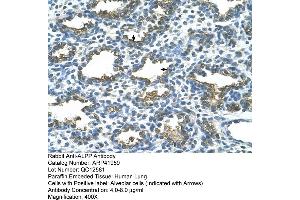 Rabbit Anti-ALPP Antibody  Paraffin Embedded Tissue: Human Lung Cellular Data: Alveolar cells Antibody Concentration: 4. (PLAP Antikörper  (C-Term))