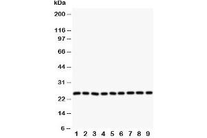 Western blot testing of SOD2 antibody and Lane 1:  rat liver;  2: (r) intestine;  3: (r) lung;  4: (r) heart;  5: human SMMC-7721;  6: (h) HeLa;  7: (h) COLO320;  8: (h) SW620;  9: (h) A549 cell lysate. (SOD2 Antikörper  (N-Term))