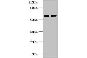 PPP2R5C Antikörper  (Regulatory Subunit Gamma)