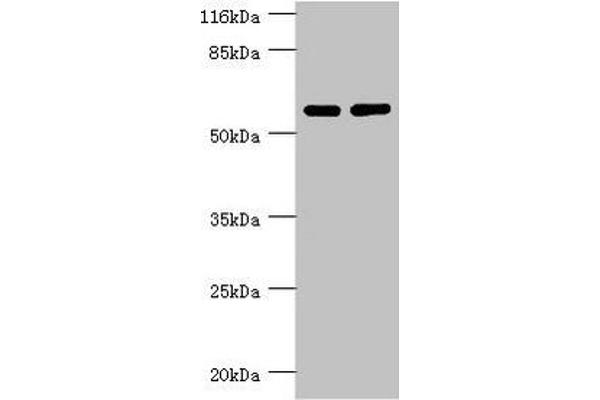 PPP2R5C Antikörper  (Regulatory Subunit Gamma)