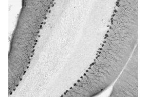 Cerebellum immunohistochemistry. (DLG2 Antikörper  (AA 1-852))