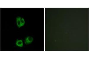 Immunofluorescence analysis of HeLa cells, using Lck (Phospho-Tyr393) Antibody. (LCK Antikörper  (pTyr394))