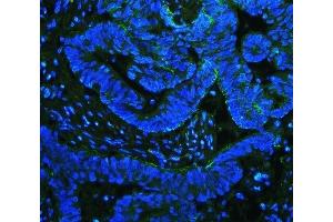 IF analysis of Integrin beta 4/ITGB4 using anti-Integrin beta 4/ITGB4 antibody (ABIN7601135). (Integrin beta 4 Antikörper  (AA 29-431))