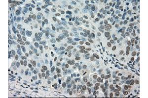 Immunohistochemical staining of paraffin-embedded Ovary tissue using anti-STK39mouse monoclonal antibody. (STK39 Antikörper)