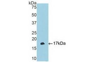 Detection of Recombinant TBX3, Human using Polyclonal Antibody to T-Box Protein 3 (TBX3) (TBX3 Antikörper  (AA 107-220))