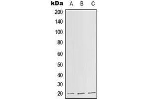 Western blot analysis of SLC25A11 expression in HepG2 (A), Raw264. (SLC25A11 Antikörper  (Center))