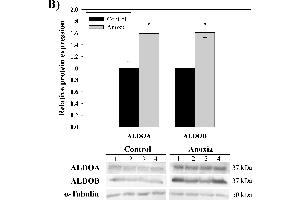 Western Blotting (WB) image for anti-Aldolase B, Fructose-Bisphosphate (ALDOB) antibody (ABIN2855024)
