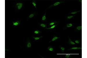 Immunofluorescence of purified MaxPab antibody to PHC1 on HeLa cell. (PHC1 Antikörper  (AA 1-957))