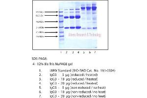Gel Scan of Immunoglobulin G3 (IgG3), Normal Human Plasma  This information is representative of the product ART prepares, but is not lot specific.