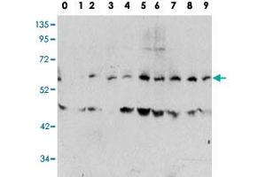 Western blot analysis of MYC (phospho T58) polyclonal antibody  in human TPA activated HeLa cell line lysates. (c-MYC Antikörper  (pThr58))