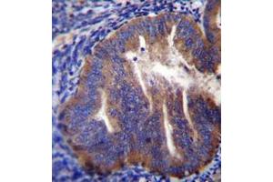 Immunohistochemistry analysis in formalin fixed and paraffin embedded human uterus tissue reacted with KLC2 Antibody (N-term) followed which was  peroxidase conjugated to the secondary antibody and followed by DAB staining. (KLC2 Antikörper  (N-Term))