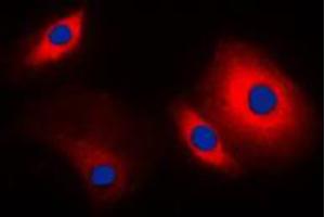 Immunofluorescent analysis of Cortactin staining in MCF7 cells. (Cortactin Antikörper  (C-Term))