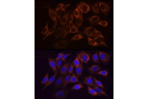 Immunofluorescence analysis of NIH/3T3 cells using NDUFS1 Rabbit pAb (ABIN7268819) at dilution of 1:50 (40x lens).