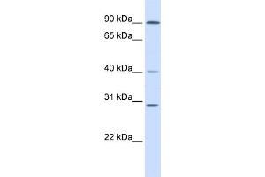 WB Suggested Anti-ERCC2 Antibody Titration:  0. (ERCC2 Antikörper  (N-Term))