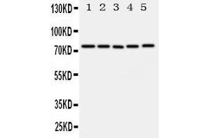 Western Blotting (WB) image for anti-ATP-Binding Cassette, Sub-Family G (WHITE), Member 1 (ABCG1) (AA 627-647), (C-Term) antibody (ABIN3044094) (ABCG1 Antikörper  (C-Term))