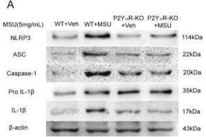 NLRP3 inflammasome activation was involved in P2Y14R deficiency. (beta Actin Antikörper  (AA 1-50))
