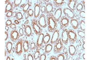 ABIN6383807 to Calnexin was successfully used to stain epithelial cells perinuclear in human renal carcinoma sections. (Calnexin Antikörper  (Lumenal Region))