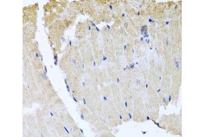 Immunohistochemistry of paraffin-embedded Mouse heart using RAB24 Polyclonal Antibody at dilution of 1:100 (40x lens). (RAB24 Antikörper)