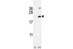 Western blot analysis of IL17F antibody and 293 cell lysate (2 ug/lane) either nontransfected (Lane 1) or transiently transfected with the IL17F gene (2). (IL17F Antikörper  (AA 16-45))