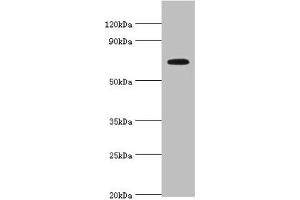 Western blot All lanes: Long-chain fatty acid transport protein 4 antibody at 8 μg/mL + Mouse heart tissue Secondary Goat polyclonal to rabbit IgG at 1/10000 dilution Predicted band size: 73, 27 kDa Observed band size: 73 kDa