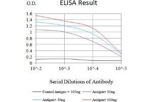 Black line: Control Antigen (100 ng),Purple line: Antigen (10 ng), Blue line: Antigen (50 ng), Red line:Antigen (100 ng) (SARS-Cov2-NP1 (AA 1-180) Antikörper)