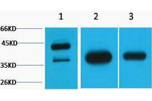 Western Blotting (WB) image for anti-Growth Associated Protein 43 (GAP43) antibody (ABIN3181291) (GAP43 Antikörper)