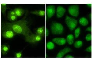 Immunofluorescence microscopy anti -THRB1 (Thyroid hormone receptor Beta 1) antibody  Tissue: Mouse Dendritic cells Primary antibody: Anti THRB1 1:100 1 hr PBS 3% BSA (left) Normal rabbit IgG isotype control (right) Secondary Ab: 488 dye conjugate 1:1000 1 hr Mounting: Fluoromount-G (Southern Biotechnology Associates, Birmingham, AL) for examination. (THRB Antikörper  (Isoform 1, N-Term))