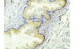 IHC analysis of ALDH1A1 using anti-ALDH1A1 antibody (ABIN7602127).