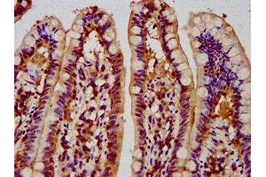 IHC image of ABIN7148695 diluted at 1:300 and staining in paraffin-embedded human small intestine tissue performed on a Leica BondTM system. (MUS81 Antikörper  (AA 82-265))