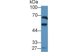 Detection of ALDH1A2 in Rat Testis lysate using Polyclonal Antibody to Aldehyde Dehydrogenase 1 Family, Member A2 (ALDH1A2) (ALDH1A2 Antikörper  (AA 1-422))