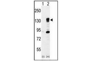 Western blot analysis of ITGA5 (arrow) using CD49e / ITGA5 Antibody (Center) Cat. (ITGA5 Antikörper  (Middle Region))
