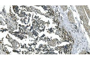 IHC analysis of CDC123 using anti-CDC123 antibody (ABIN7599284).