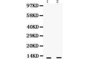 Western Blotting (WB) image for anti-S100 Calcium Binding Protein A6 (S100A6) (AA 1-90) antibody (ABIN3043320) (S100A6 Antikörper  (AA 1-90))
