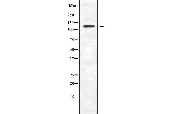 Phospholipase C beta 4 Antikörper  (Internal Region)