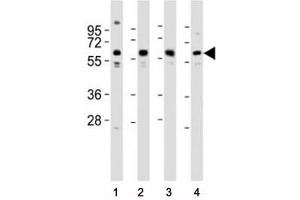 Western blot testing of Pyruvate Kinase antibody at 1:2000 dilution. (PKM2 Antikörper  (AA 121-151))