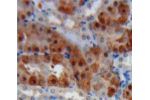 IHC-P analysis of Kidney tissue, with DAB staining. (Cathepsin K Antikörper  (AA 115-329))
