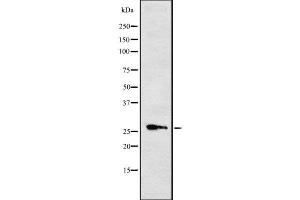 Western blot analysis of Cytochrome b561 using RAW264. (CYB561 Antikörper  (Internal Region))