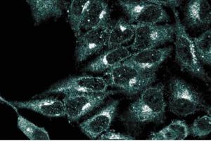 Immunofluorescence staining of HeLa cells (Human cervical epitheloid carcinoma, ATCC CCL-2. (VCP Antikörper  (AA 9-130))